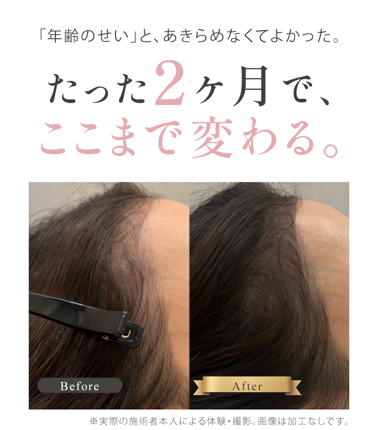 2ヶ月のビフォーアフター画像