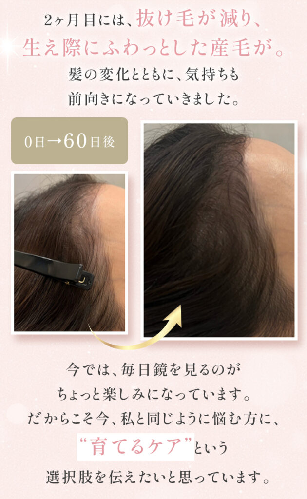 育毛2ヶ月間の変化