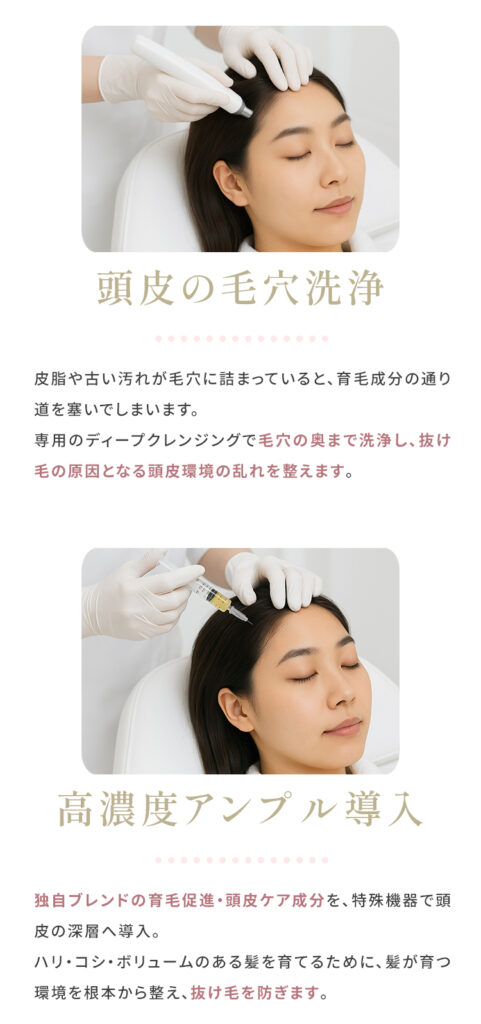 頭皮の毛穴洗浄、高濃度アンプル導入について
