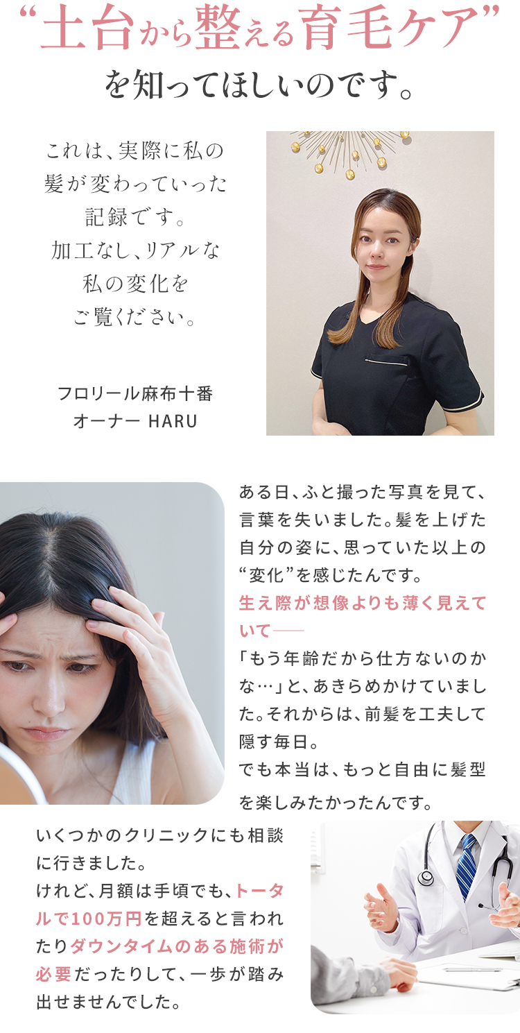 オーナーの育毛体験談