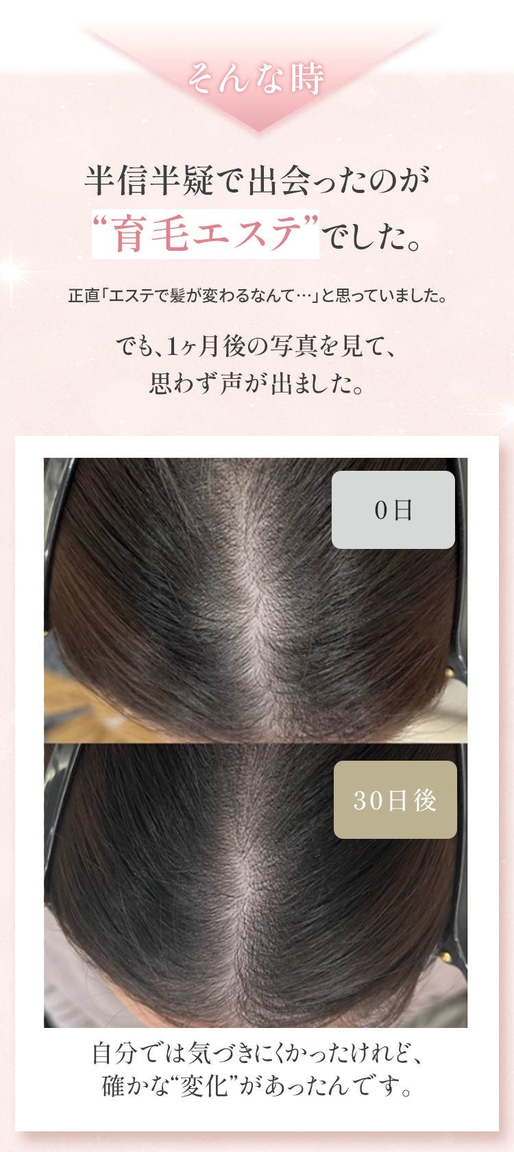 育毛1ヶ月の効果