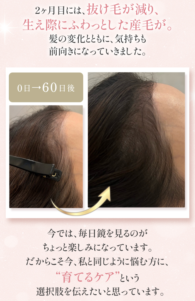 ビフォーアフター/2か月育毛エステの効果