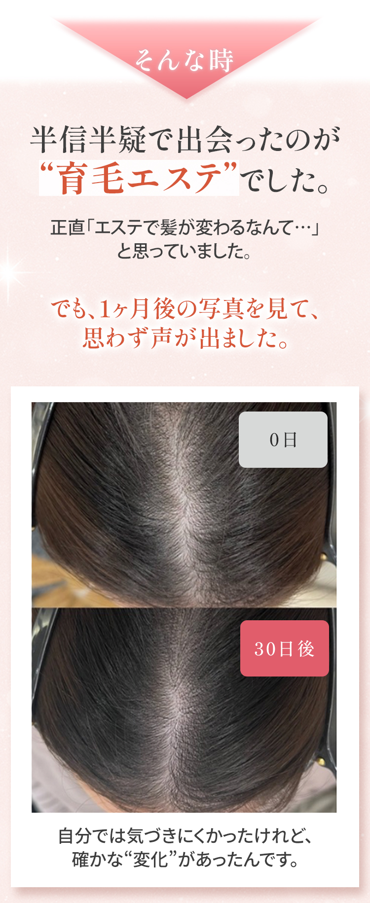 育毛エステ、1ヶ月の変化