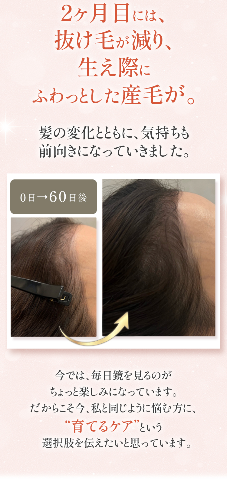 育毛エステ、2ヶ月の変化