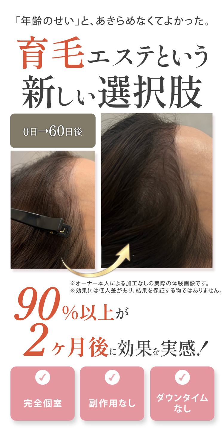 育毛エステという新しい選択肢 90％が2ヶ月で効果を実感