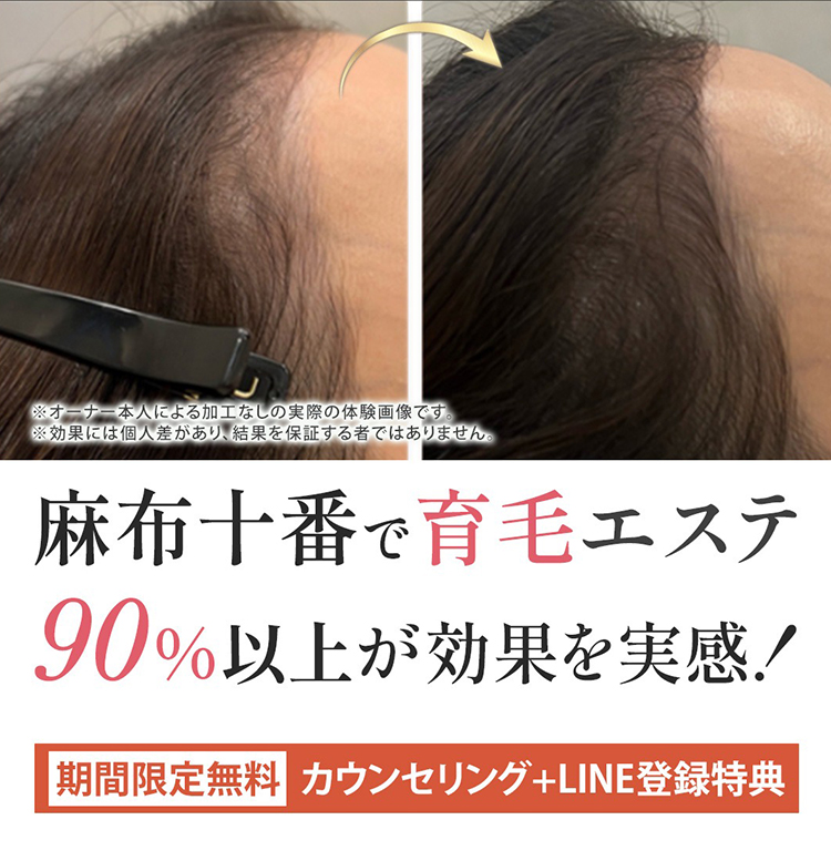 麻布十番の育毛エステ 90％以上が効果を実感
